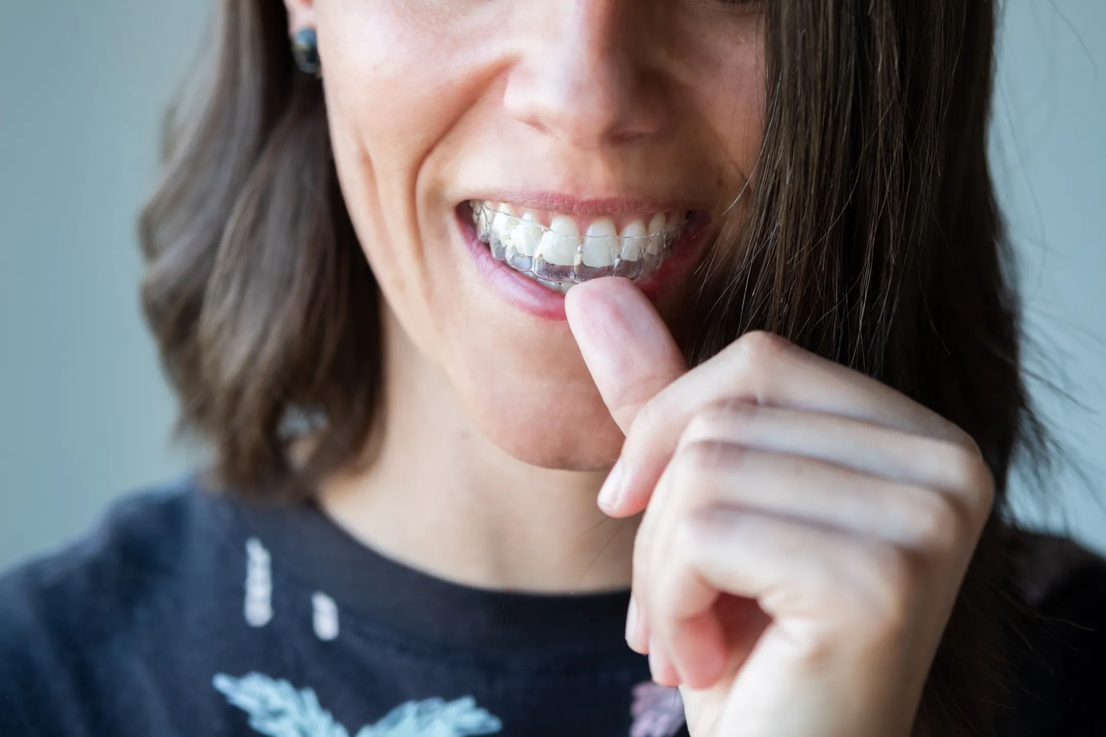 Close-up of woman inserting a clear dental aligner onto her teeth with her finger.