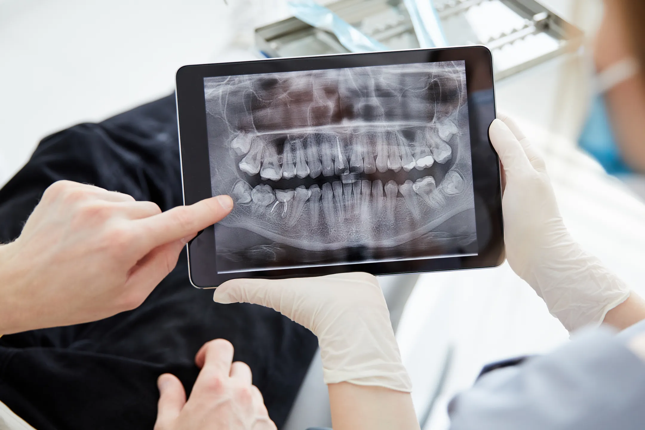 Digital X-rays
